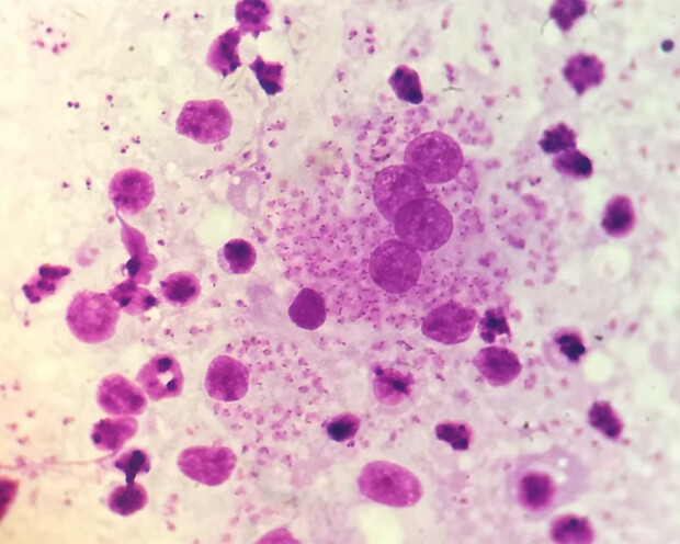 Ostravští vědci umí „zkrotit“ viry